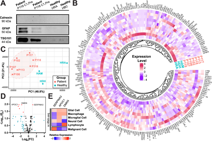 Fig. 3: Proteomic profiling of tumor and healthy control EVPs.