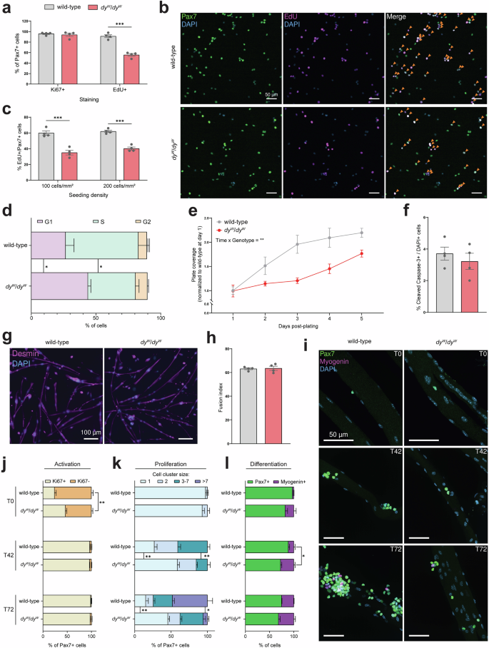 Fig. 3: 
                        $$d{y}^{W}/d{y}^{W}$$
                        
                          d
                          
                            
                              y
                            
                            
                              W
                            
                          
                          /
                          d
                          
                            
                              y
                            
                            
                              W
                            
                          
                        
                       MuSCs proliferate more slowly than wild-type MuSCs ex vivo.