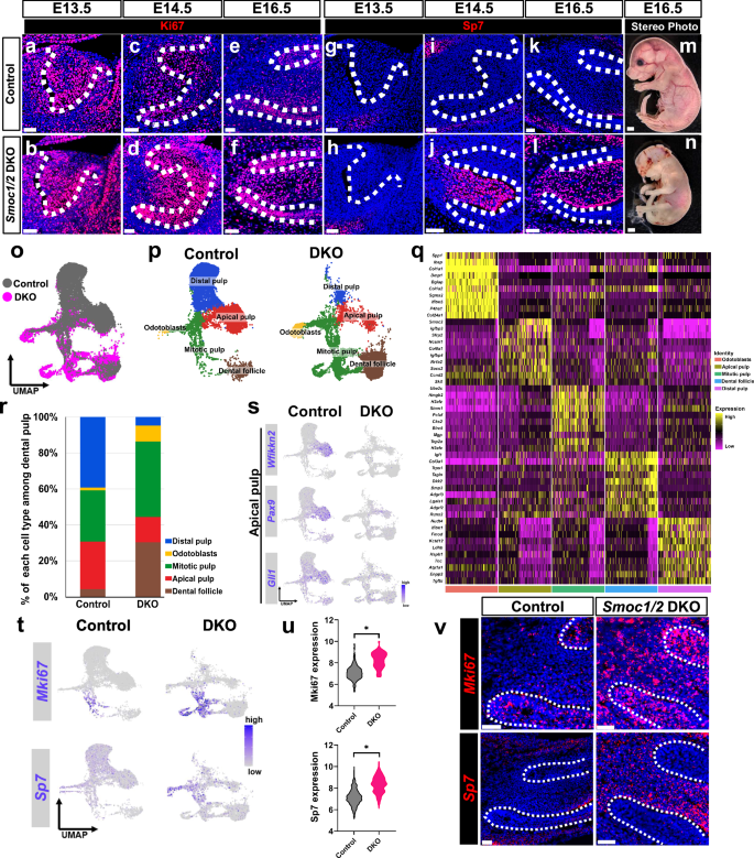 Fig. 5: Loss of Smoc1/2 leads to quiescence loss and mesenchymal hierarchy disruption.
