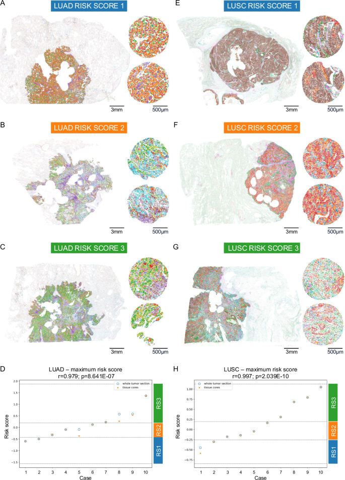 Fig. 8: Niche patterns on whole tumor sections.
