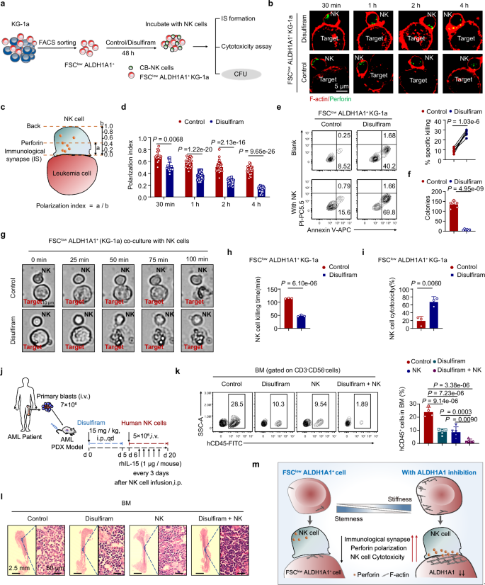 Fig. 7: Leukemia cell stiffening via ALDH1A1 inhibition enhances the efficacy of NK cell immunotherapy.