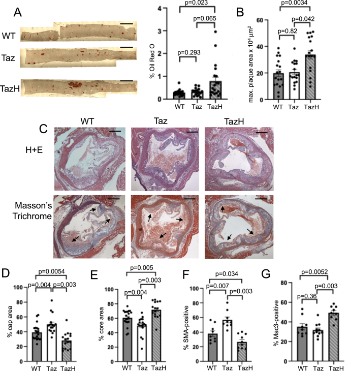 Fig. 6: VSMC tafazzin has important effects on atherogenesis.