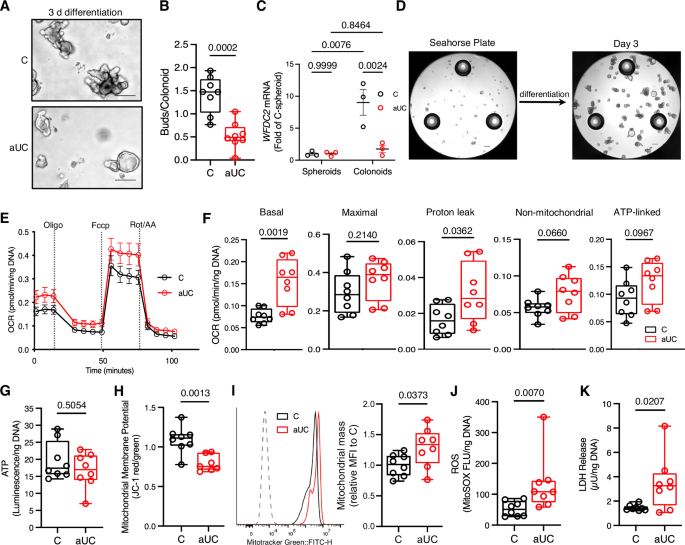 Fig. 1: Hypermetabolism and cellular stress in active UC colonoids during differentiation.