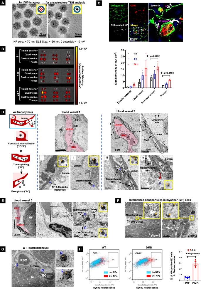 Fig. 2: Systemically administered NPs biodistribute to dystrophic muscles.