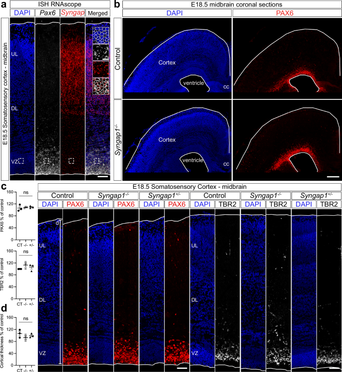 Fig. 1: Syngap1 levels do not affect the number of progenitor cells in mice.