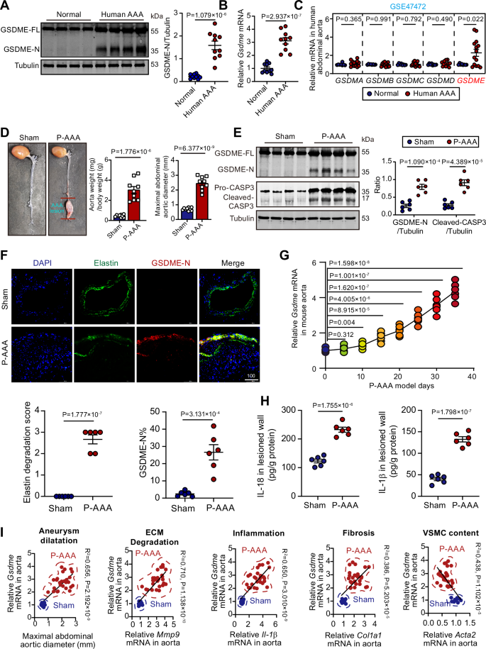 Fig. 1: GSDME is activated in the vascular wall of patients and mice with AAA.
