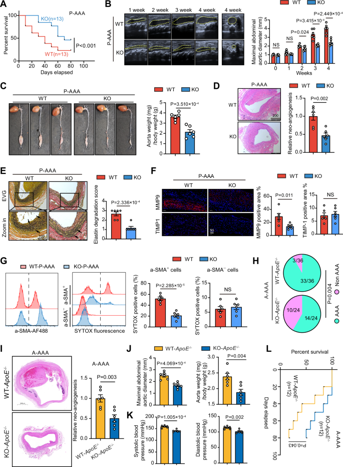 Fig. 2: Global knockout of GSDME alleviates AAA pathologies in mouse models.