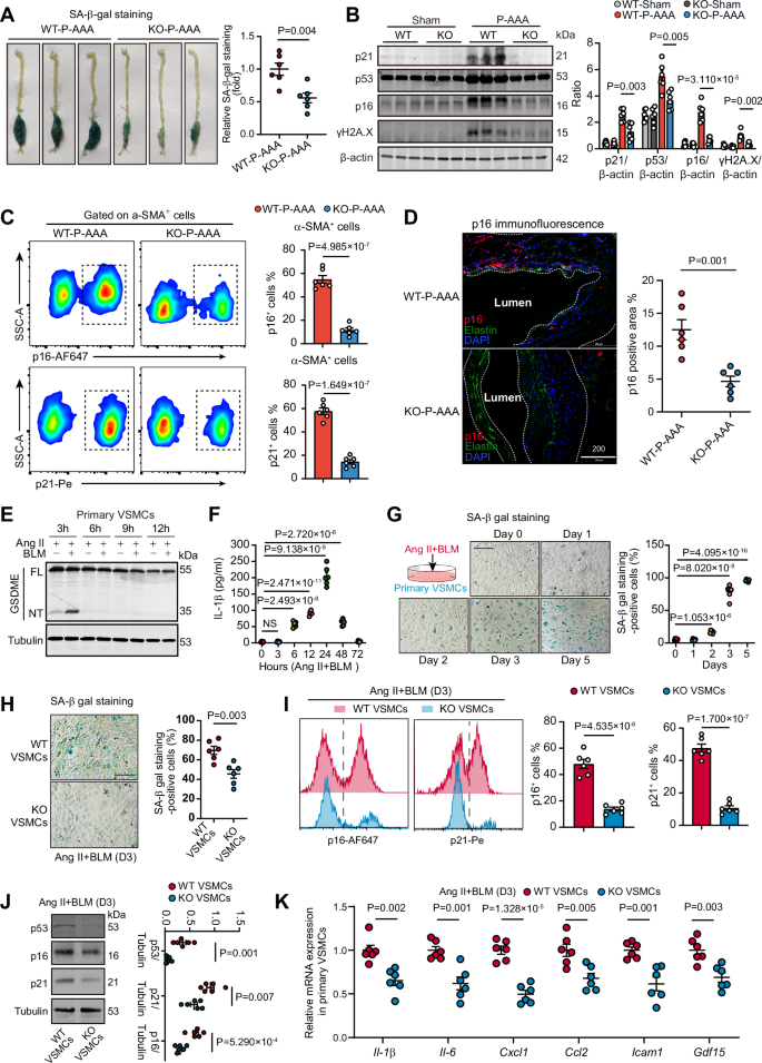 Fig. 4: GSDME is essential for the vascular senescence during AAA.