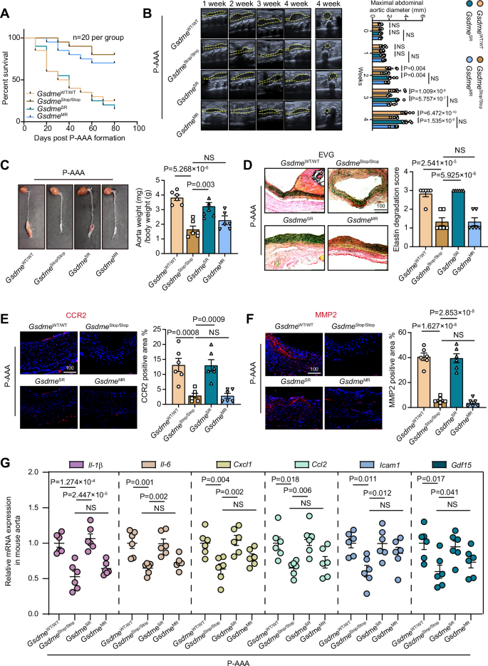 Fig. 7: GSDME in VSMCs mediates senescence in AAA.