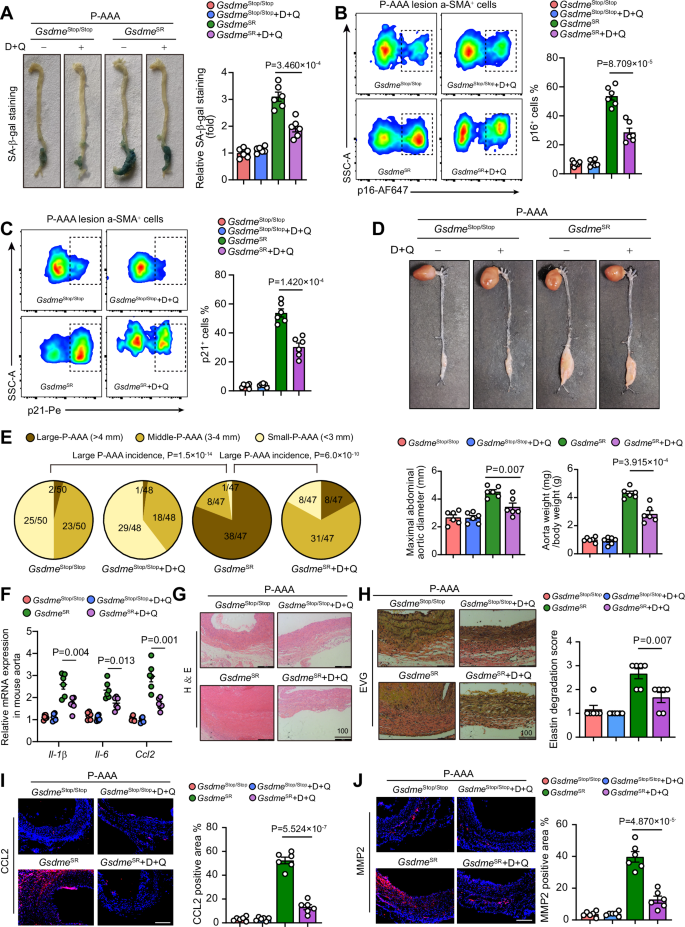 Fig. 8: Senolytic therapy ameliorates AAA pathologies in mice with VSMC-specific rescue of GSDME.