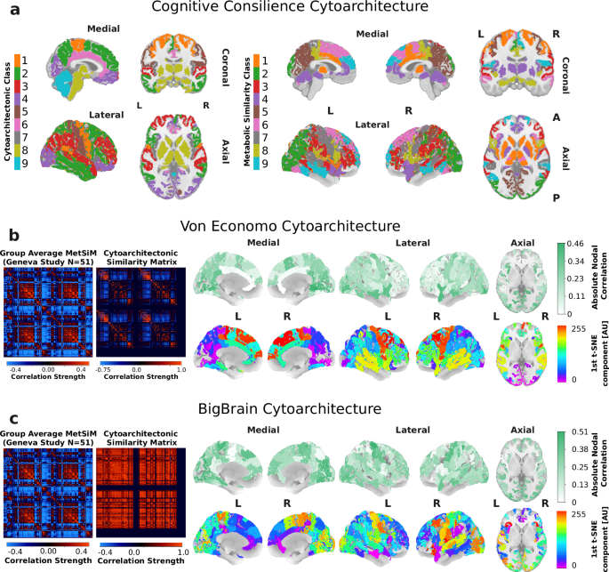 Fig. 7: Metabolic Similarity and Cytoarchitectural Similarity.