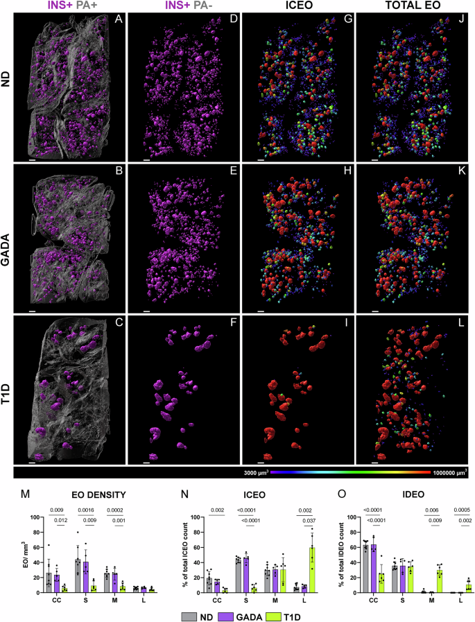 Fig. 2: 3D islet distribution across human ND, GADA, and T1D pancreas samples.