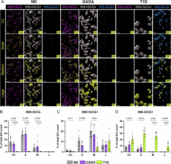 Fig. 3: Spatial arrangement and islet size category contribution in human ND, GADA, and T1D pancreas.
