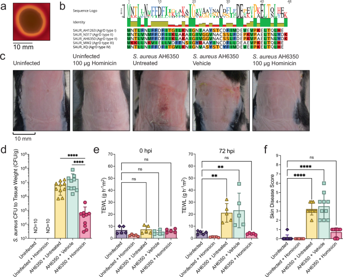 Fig. 7: AH5011 hominicin is protective against S. aureus skin infection.