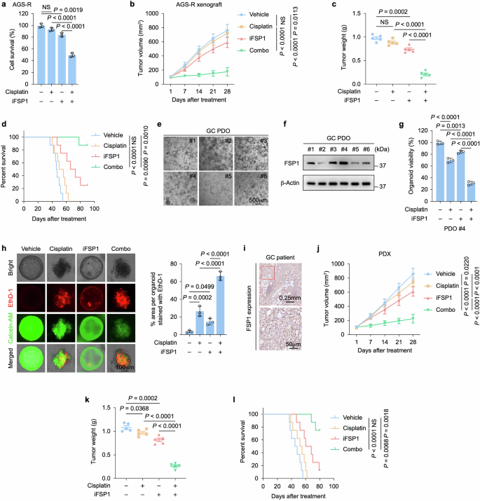 Fig. 7: FSP1 inhibition reverses GC chemoresistance.