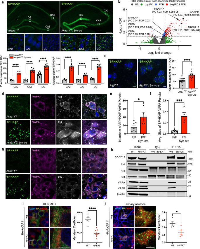 Fig. 6: Characterization of SPHKAP and VAP proteins in neurons from Akap11-cKO and Atg7-cKO mouse brains.