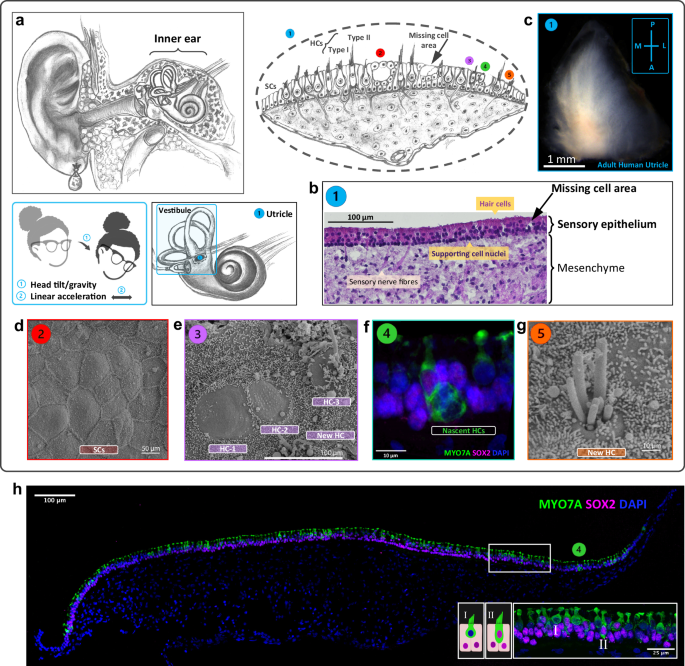 Fig. 1: A close look inside the inner ear: the balance organ and its sensory epithelium.