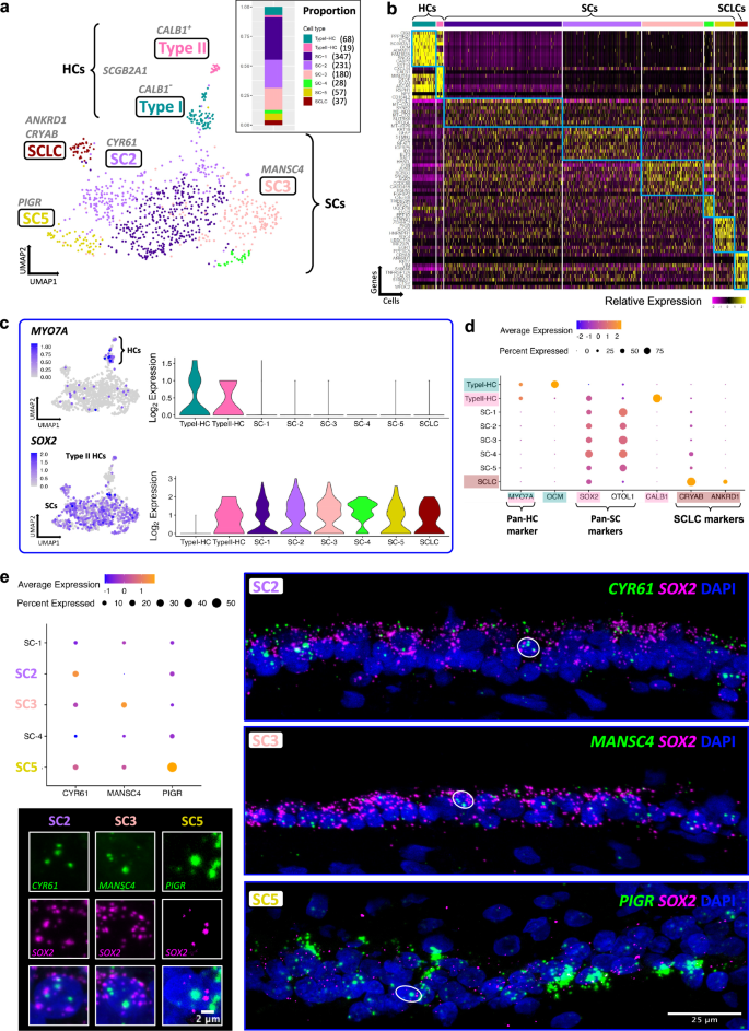 Fig. 2: Heterogeneity of utricle sensory epithelium.