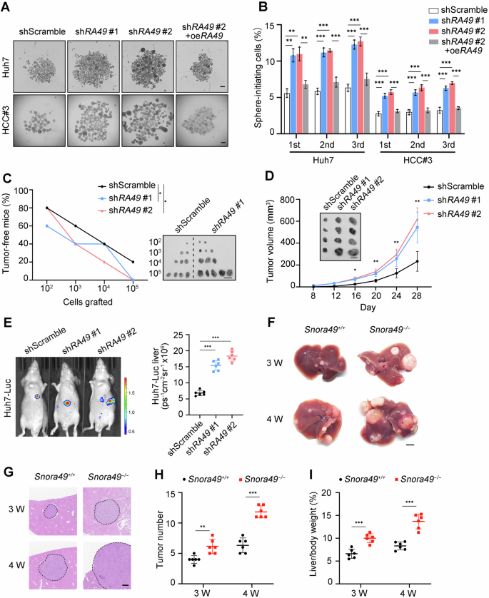 Fig. 2: SNORA49 depletion and knockout promote self-renewal of liver CSCs and HCC progression.