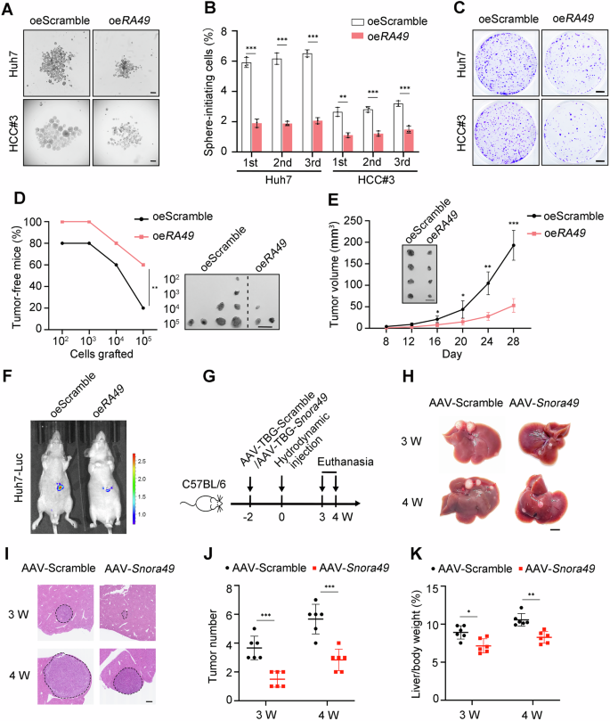 Fig. 3: Overexpression of SNORA49 suppresses stemness of liver CSCs and tumor formation.
