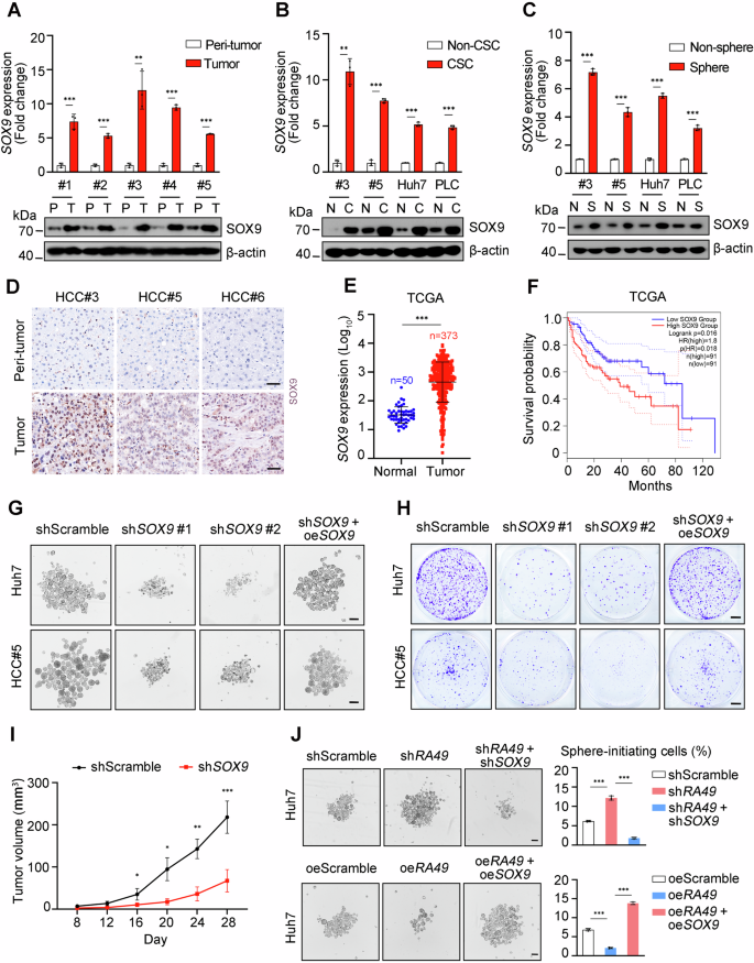 Fig. 6: SOX9 is highly expressed in liver CSCs and promotes self-renewal of liver CSCs and HCC tumorigenesis.