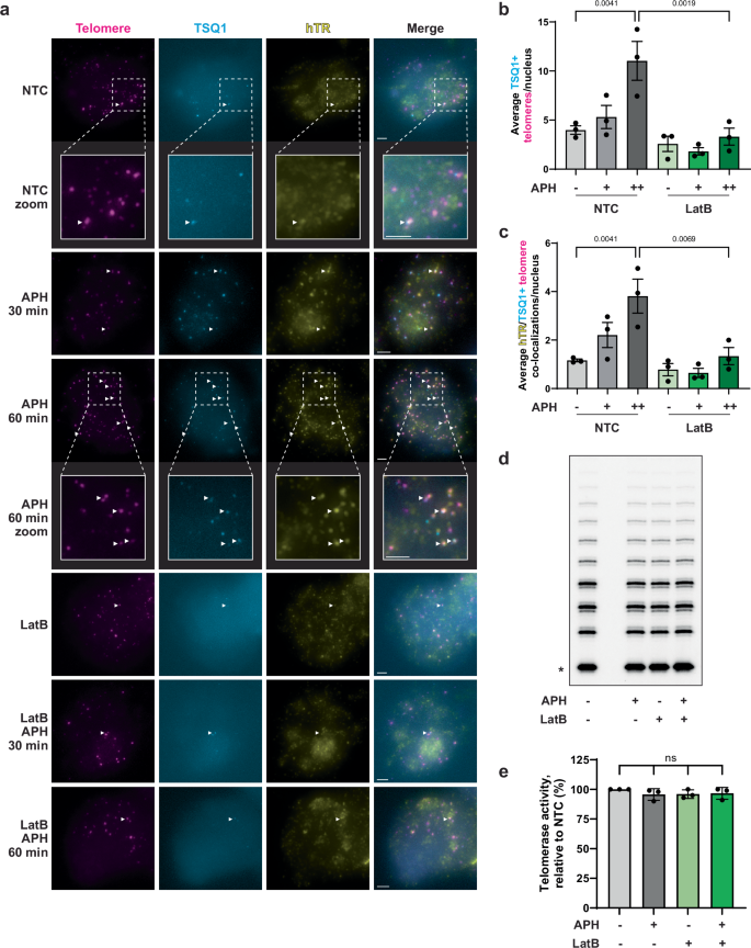 Fig. 2: F-actin polymerization is required for in situ telomere extension by telomerase.