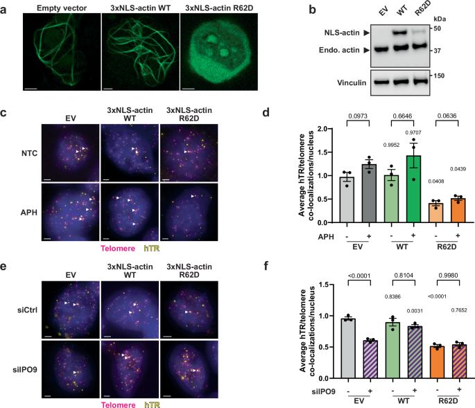 Fig. 4: Nuclear F-actin polymerization is required for telomerase recruitment.