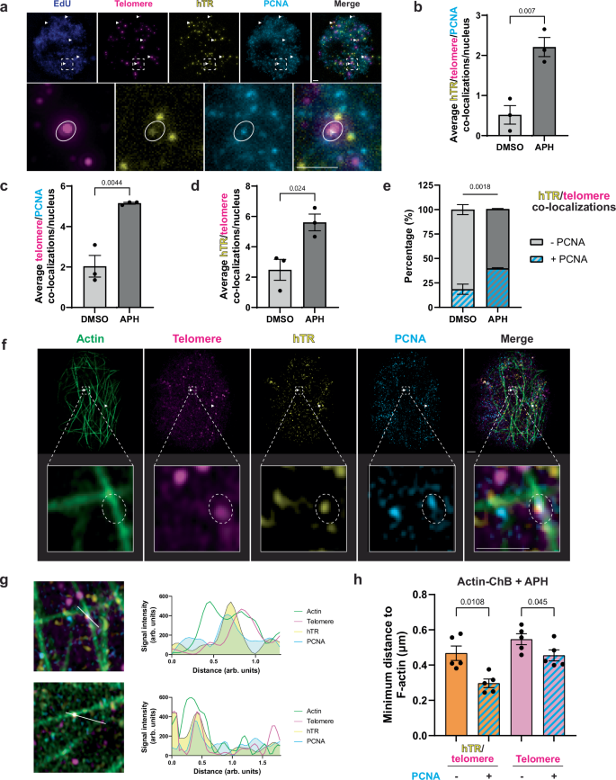 Fig. 7: Stalled replication forks promote telomerase recruitment at F-actin.