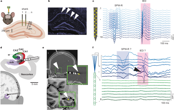Fig. 1: Comparison to standard recordings in rodent hippocampus demonstrates limitations of human recordings.