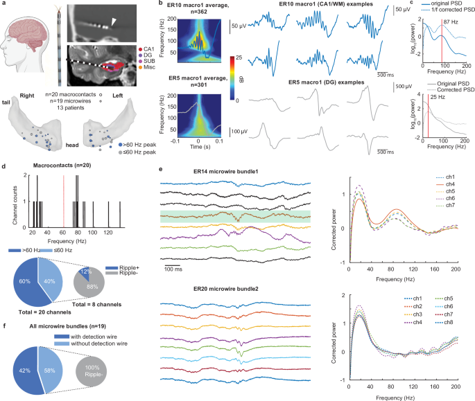 Fig. 3: A spectral narrowband peak in peri-event PSDs guides ripple-positive channel selection in humans.