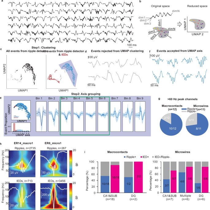 Fig. 4: Semi-automated separation of ripples and false positives.
