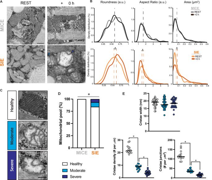Fig. 3: Morphological and ultrastructural disturbances to mitochondria following SIE.