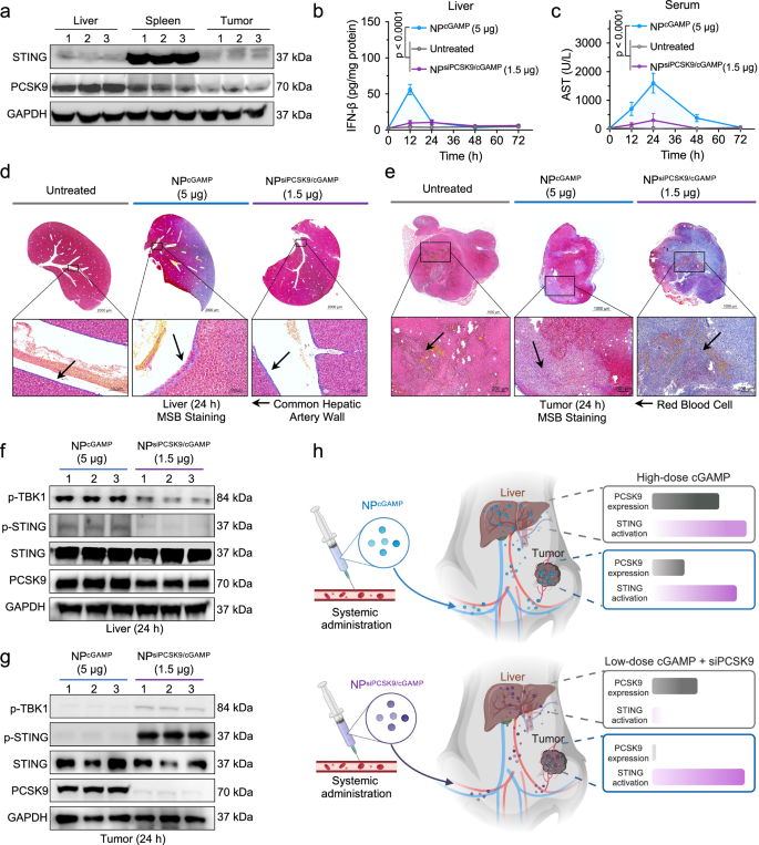 Fig. 6: PCSK9 silencing promotes tumor-specific STING activation and spares the liver from toxicity.