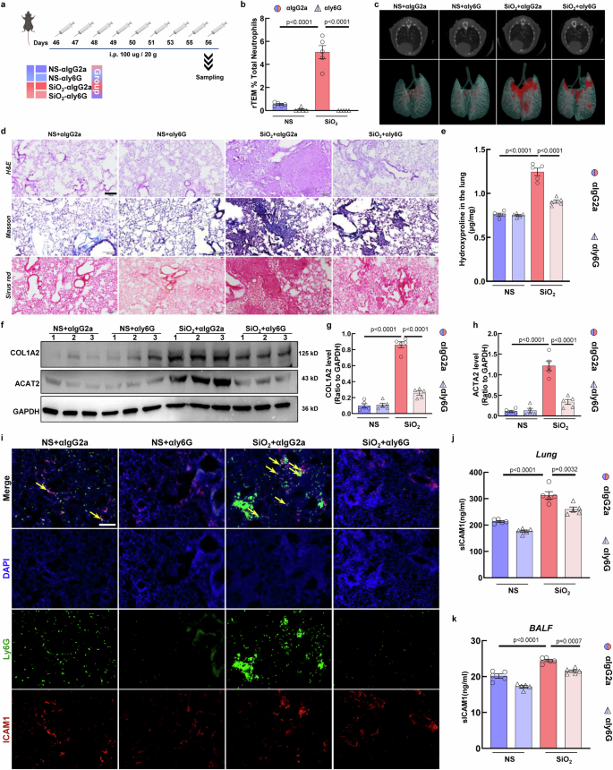 Fig. 7: Neutrophil depletion alleviates pulmonary fibrosis.