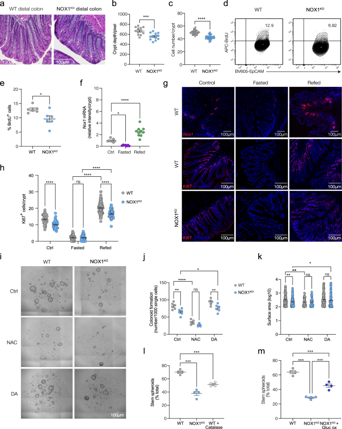 Fig. 2: NOX1-derived ROS regulates the balance of self-renewal and differentiation in the distal colon in homeostasis and during regeneration.