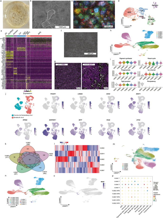 Fig. 1: Genetically balanced hESC lines differentiate into RPE with individual gene-expression signatures as well as astrocytes and pigmented ciliary body cells.