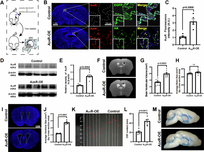 Fig. 2: Overexpression of A2AR selectively in the choroid plexus (ChP) (A2AR-OE) leads to cerebrospinal fluid (CSF) hypersecretion and enlarged ventricles.