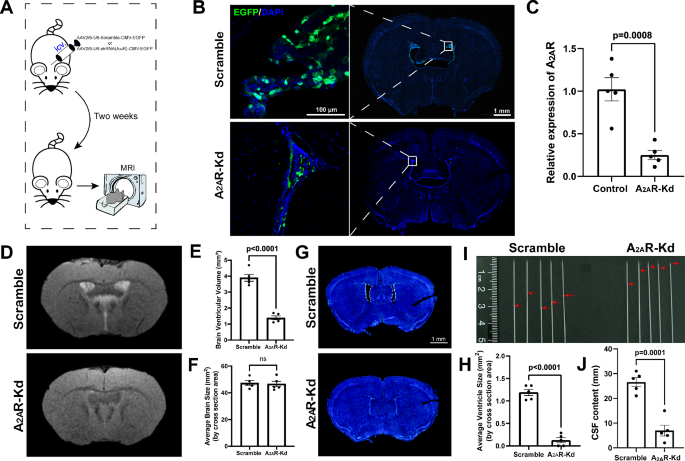 Fig. 3: Choroid plexus (ChP)-selective knockdown of A2AR (A2AR-Kd) leads to reduced cerebrospinal fluid (CSF) secretion and ventricular size.