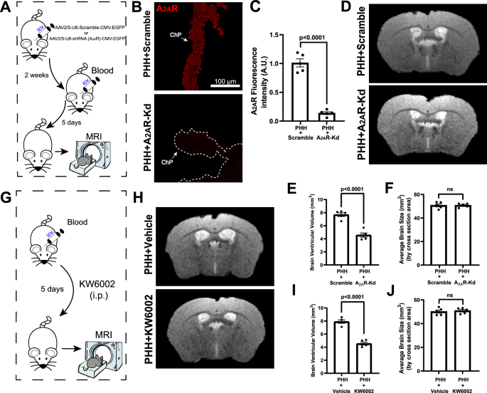 Fig. 4: Target inactivation of A2AR in the choroid plexus (ChP) alleviates hydrocephalus pathology.