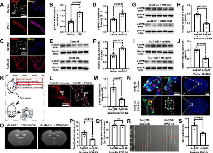 Fig. 5: A2AR signaling controls cerebrospinal fluid (CSF) secretion via SPAK phosphorylation in the choroid plexus (ChP).
