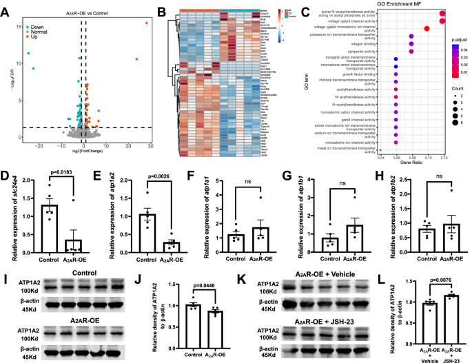 Fig. 6: Overexpression of A2AR modulates the expression of ion channel proteins in the choroid plexus (ChP).