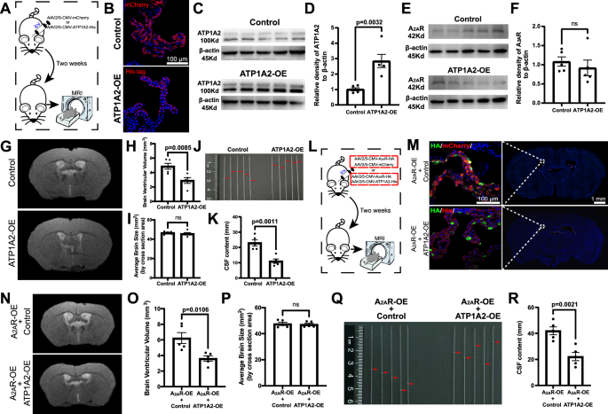 Fig. 7: A2AR signaling in the choroid plexus (ChP) controls cerebrospinal fluid (CSF) secretion through transcriptional regulation of ATP1A2.