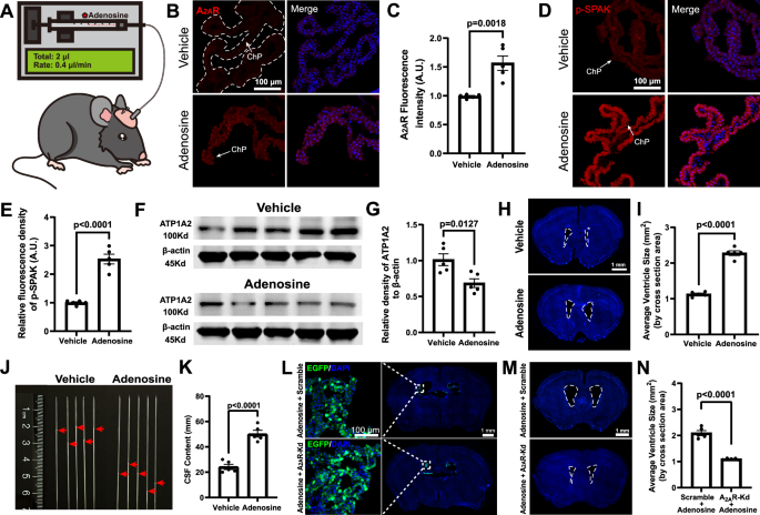 Fig. 8: ICV-injection of adenosine triggered a hydrocephalus phenotype via activation of A2AR signaling in the choroid plexus (ChP).