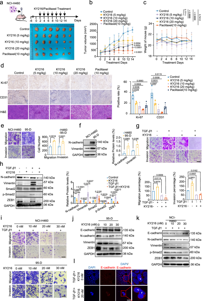 Fig. 3: KY216 effectively blocks NSCLC growth in vivo and metastasis in vitro.