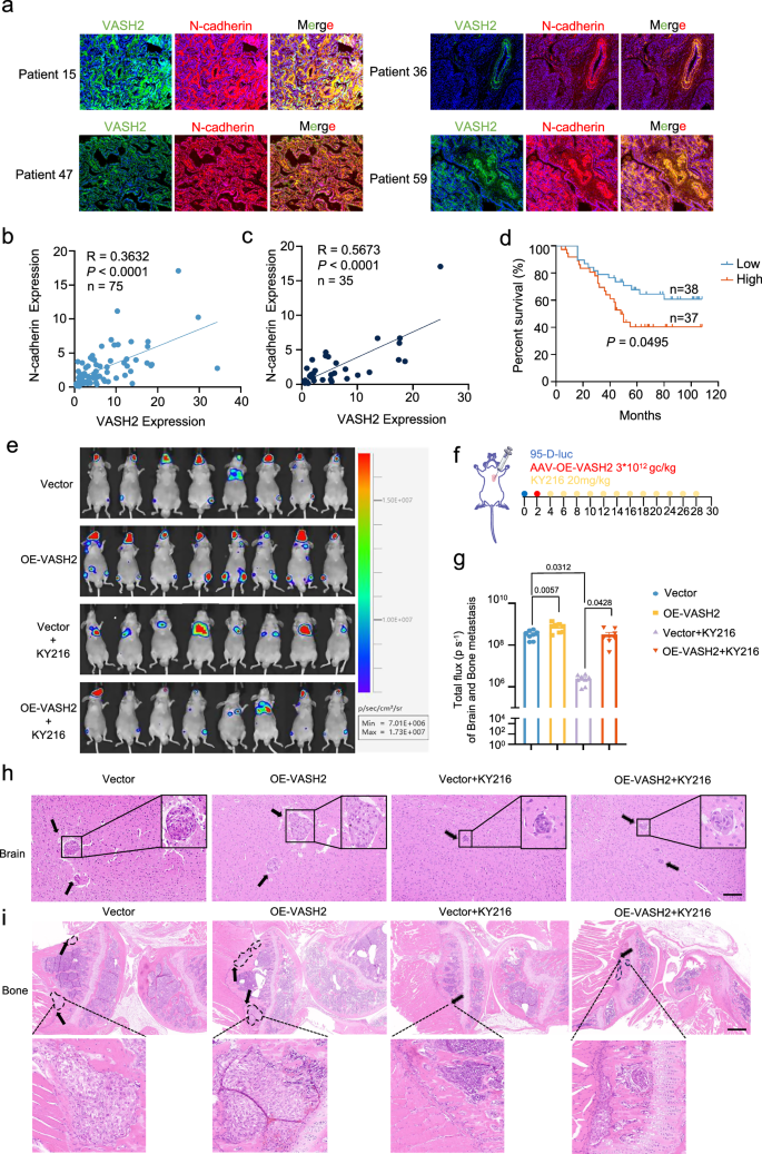 Fig. 7: The inhibitory effect of KY216 on NSCLC metastasis in vivo is dependent on VASH2.