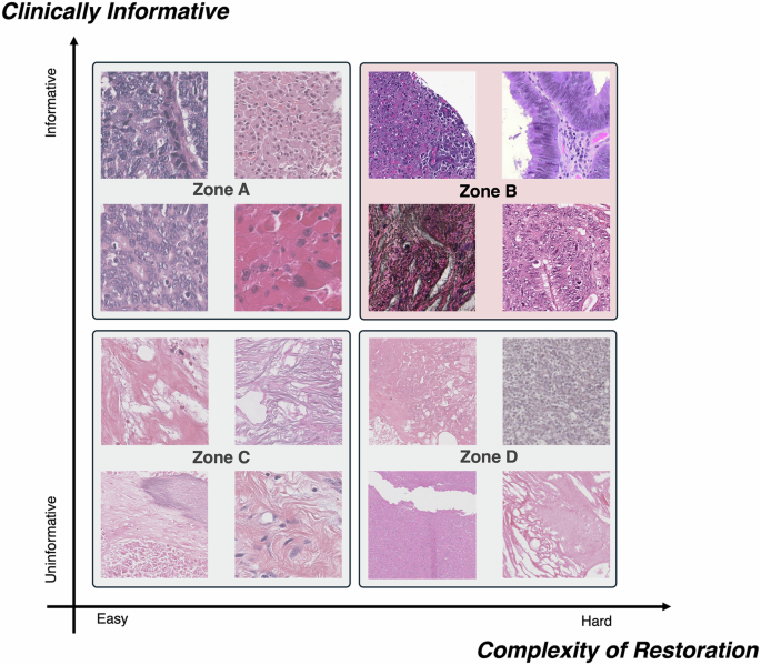 Fig. 2: Example of the hypothesis field of AdaSlide.