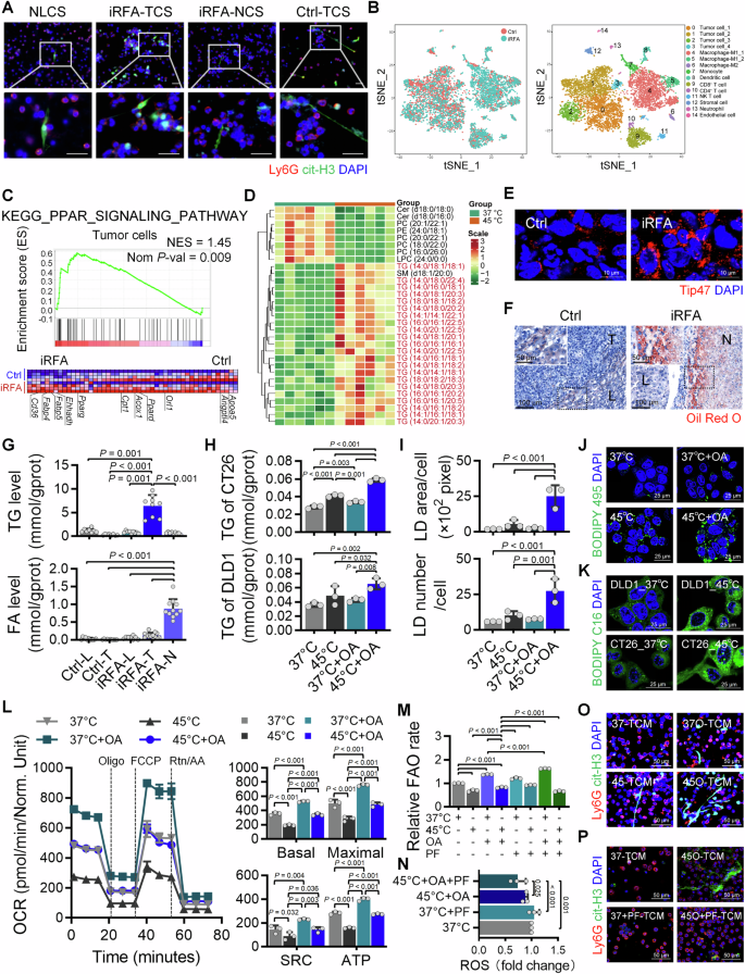Fig. 4: iRFA induces TG accumulation and FAO homeostasis in residual tumor cells.