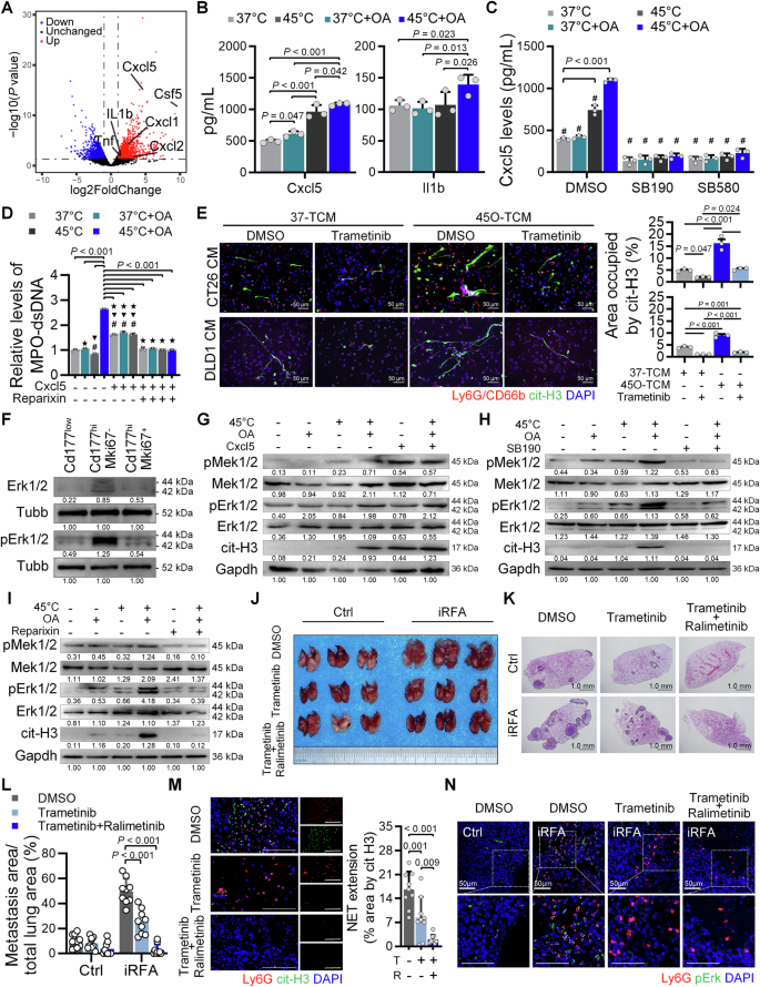 Fig. 7: The P38 MAPK-CXCL5-pERK axis in residual tumor cells mediates NET formation and lung metastasis.
