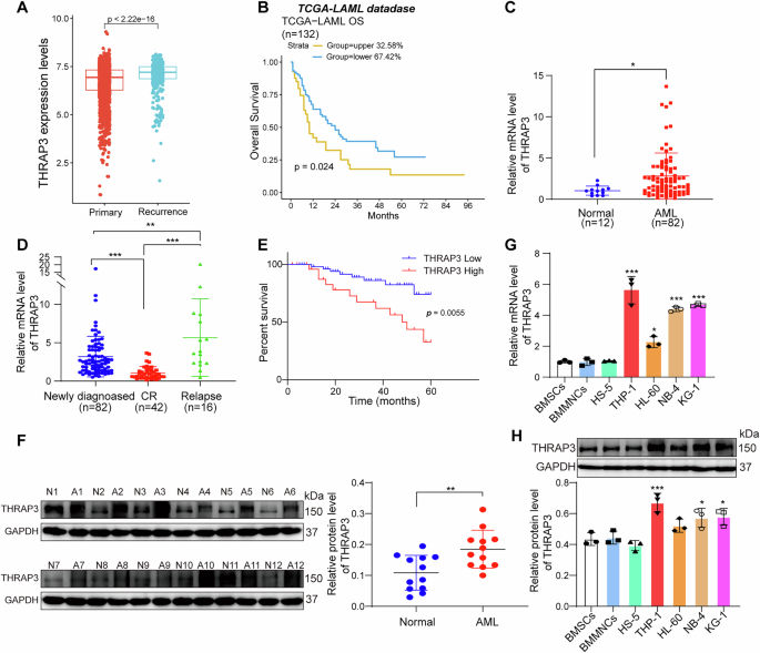 Fig. 1: High expression of THRAP3 in AML was associated with a poor prognosis of AML patients.