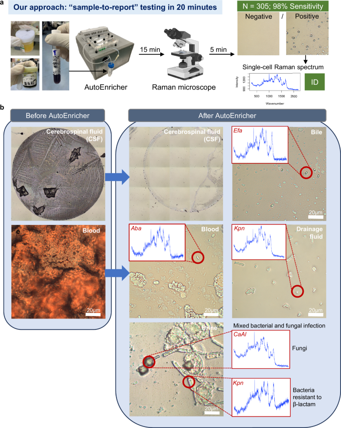 Fig. 7: Rapid clinical pathogen identification using the enrichment system and Raman microscopy.